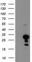 TP73-AS1 / KIAA0495 Antibody (clone OTI2A2)