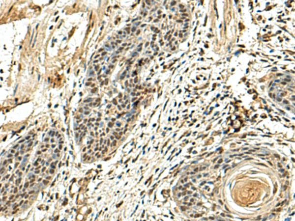 Polyclonal Rabbit anti-Human NUTF2 / PP15 Antibody (IHC)