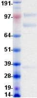 Human MST1R / RON Protein (Recombinant DDK (Flag)-His, C-terminus)