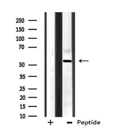 CPN2 Antibody