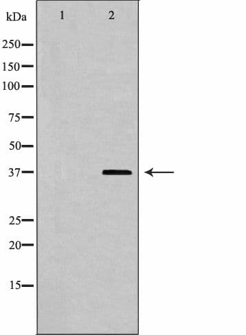 Polyclonal Rabbit anti-Human KIR2DL3 / CD152B2 Antibody (IHC, IF, WB)