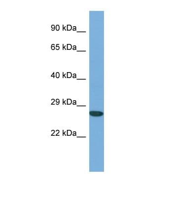 BAF53 / ACTL6A Antibody (aa81-130)