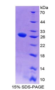 Rat WIF1 Protein (Recombinant His-T7)