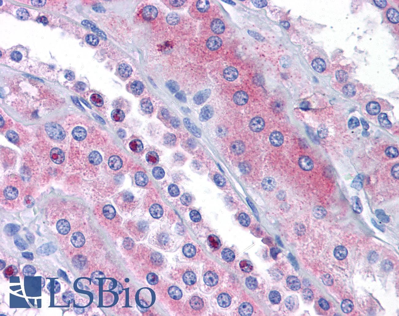 IHC-plus™ ACOT13 / THEM2 Antibody