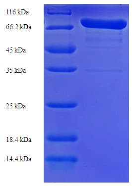 Streptococcus pneumoniae Pneumolysin Protein (Recombinant His-SUMO)