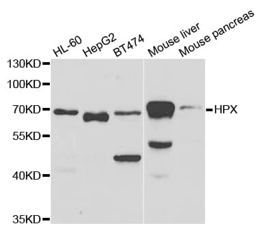 Polyclonal Rabbit anti-Human HPX / Hemopexin Antibody (IHC, IF, WB)