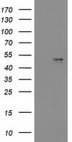 PDGF-D Antibody (aa19-247, clone OTI1C1)