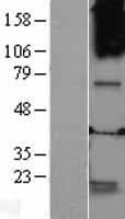 GABRQ / THETA Protein (Over-Expression Lysate Myc-DDK (Flag))