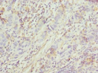 FGD5 Antibody