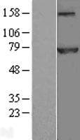 Human APC6 / CDC16 Protein (Over-Expression Lysate Myc-DDK (Flag))
