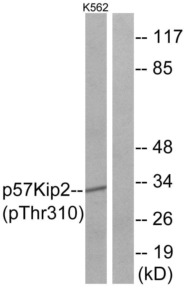 Polyclonal Rabbit anti-Human CDKN1C / p57 Kip2 Antibody (phospho-Thr310, IHC, IF, WB)