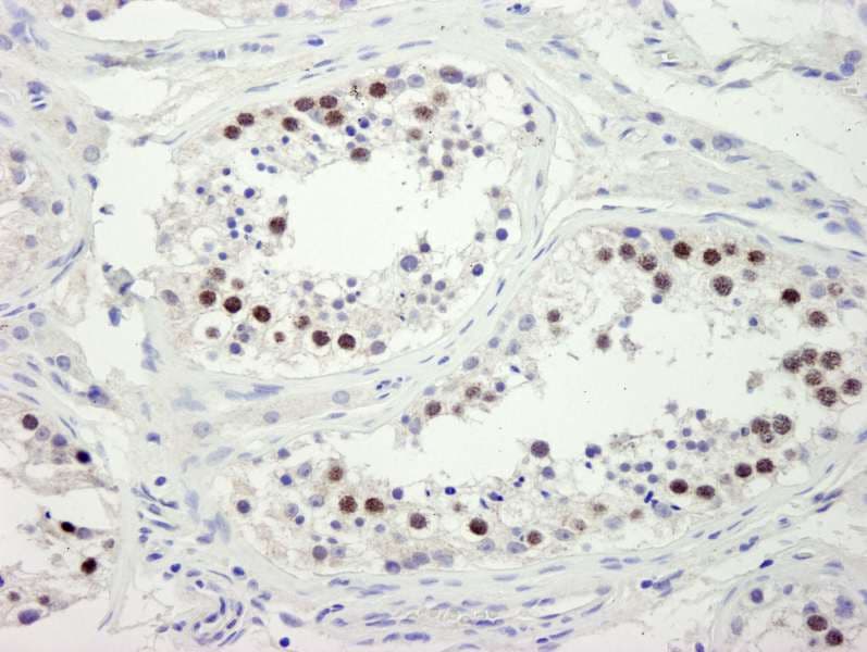 ZWINT Antibody (aa225-C-term)