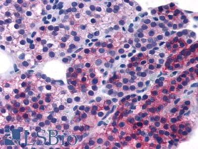 PathPlus™ Polyclonal Rabbit anti-Human CASR/Calcium Sensing Receptor Antibody (N-Terminus, IHC)