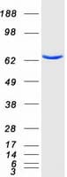 Human PCK1 Protein (Recombinant Myc-DDK (Flag))