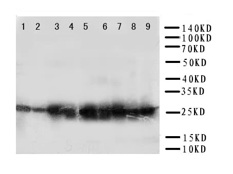 Polyclonal Rabbit anti-Human PRDX3 / Peroxiredoxin 3 Antibody (aa239-256, IHC, WB)