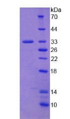 Human COL1A2 / Collagen I Alpha 2 Protein (Recombinant His)