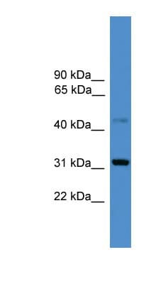 CD38 Antibody (C-Terminus)