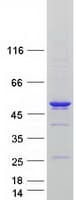 Human AURKA / Aurora-A Protein (Recombinant Myc-DDK (Flag))