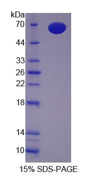 Mouse TLR9 Protein (Recombinant His-GST, N-terminus)