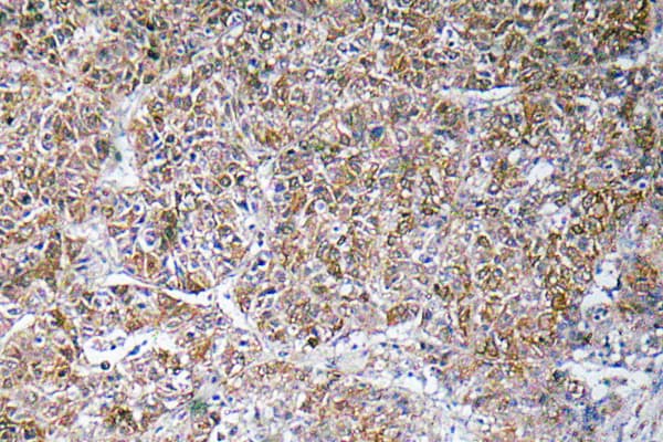 Polyclonal Rabbit anti-Human DBI / ACBD1 Antibody (aa25-74, IHC, WB)