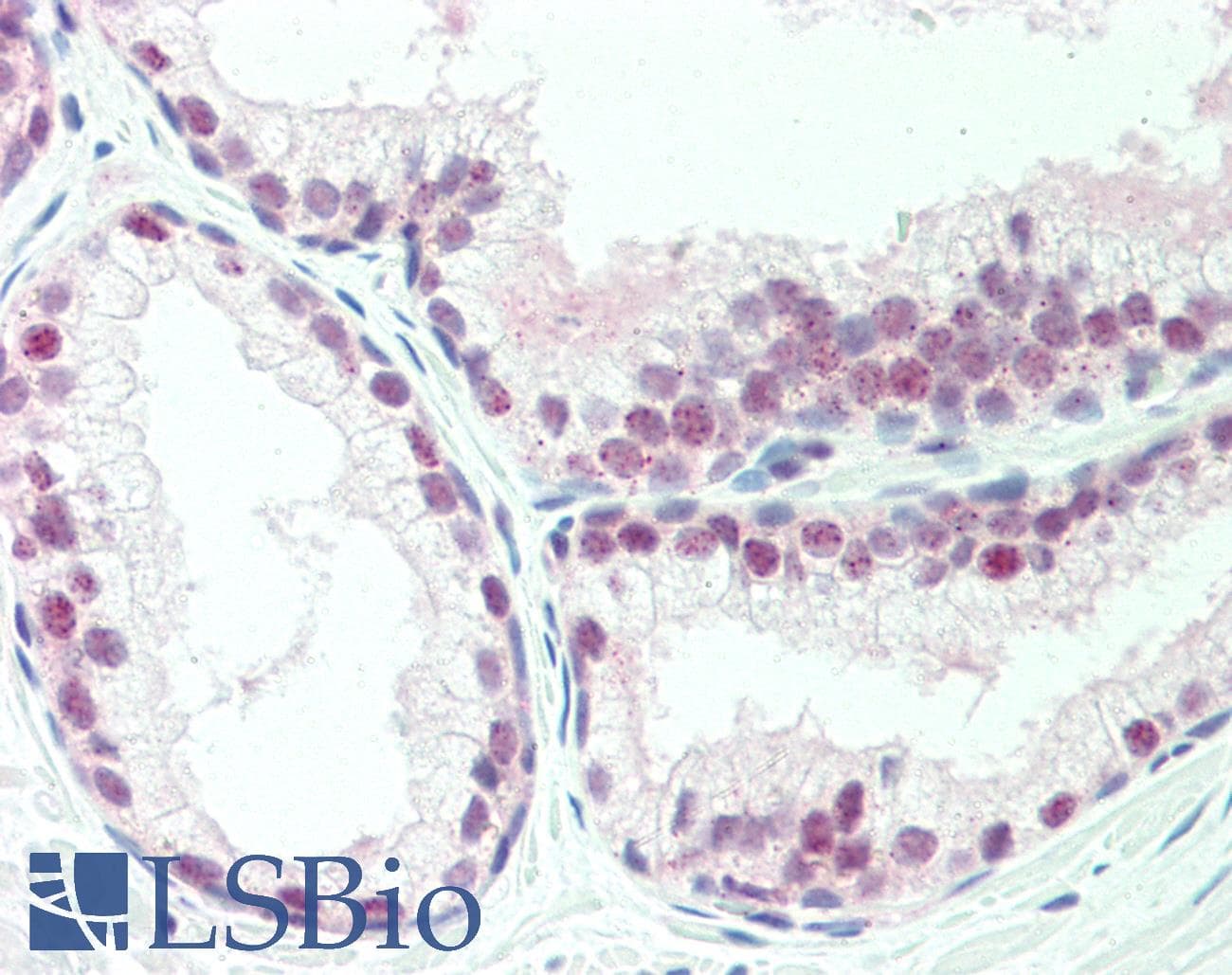 IHC-plus™ Polyclonal Rabbit anti-Human TAF1 Antibody (IHC, WB)