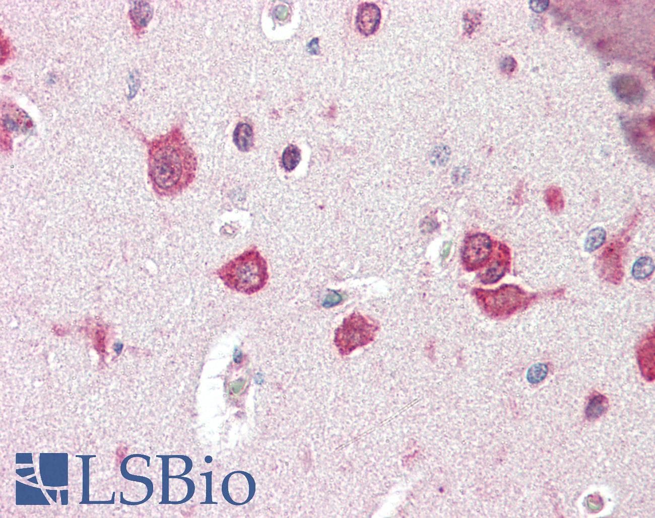 Polyclonal Rabbit anti-Human TSLP Antibody (IHC, IF, WB)