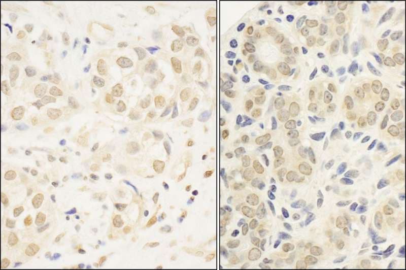 Polyclonal Rabbit anti-Human cmyb Antibody (aa225-275, IHC)