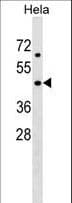 Polyclonal Rabbit anti-Human CerS6 / LASS6 Antibody (aa335-361, WB)