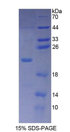 Human PLCB3 Protein (Recombinant His-T7)