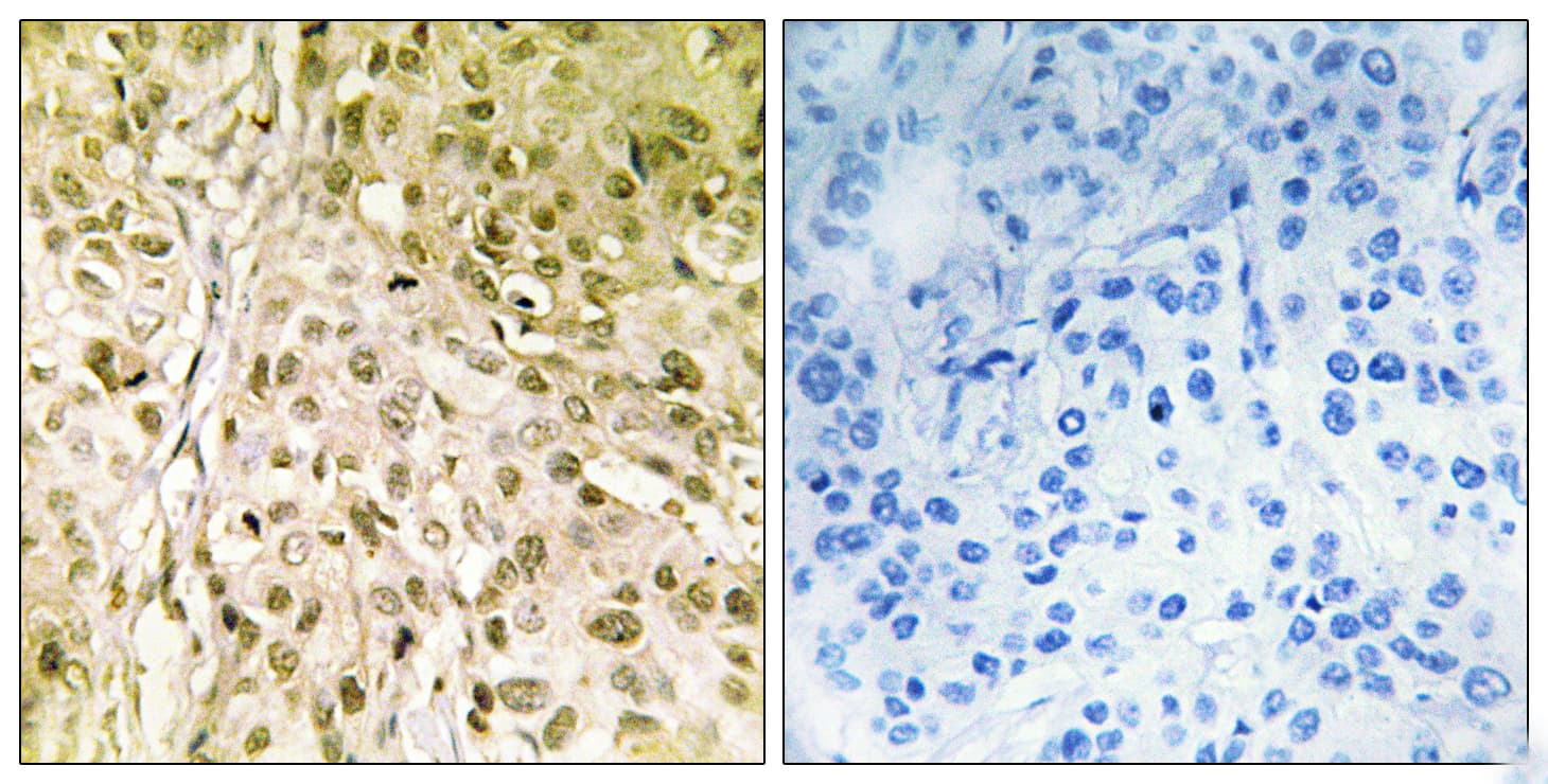 Polyclonal Rabbit anti-Human POLQ / DNA Polymerase Theta Antibody (aa181-230, IHC)