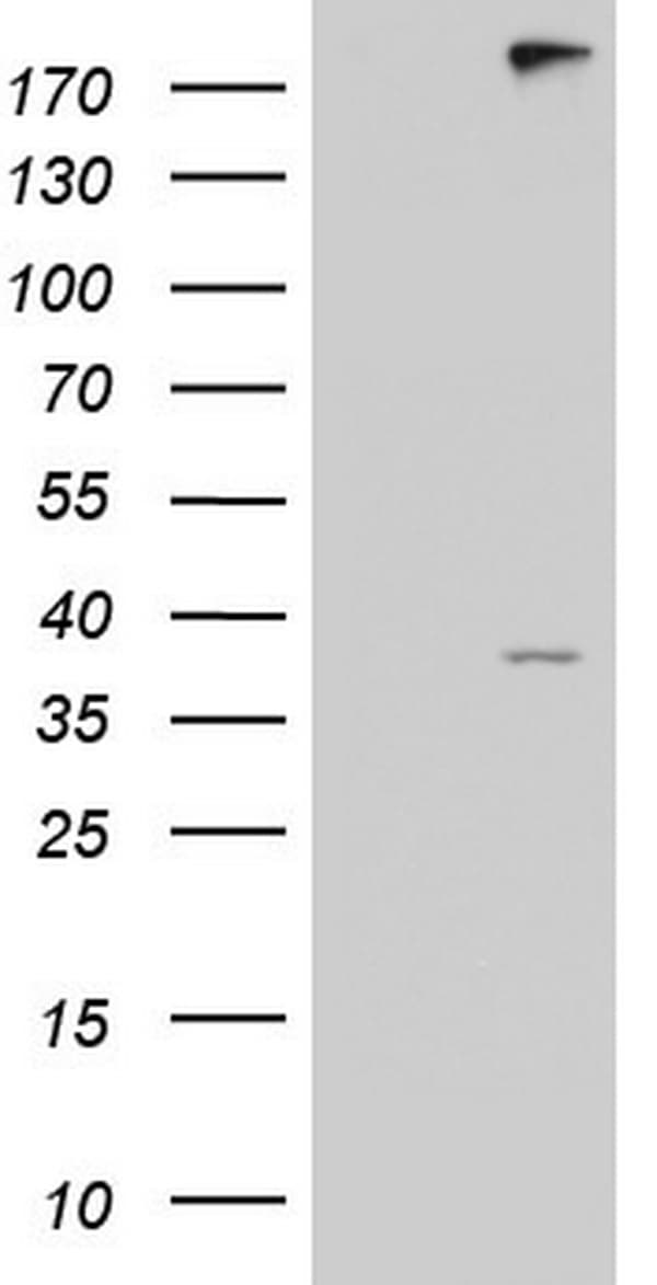 ANO1 / DOG1 / TMEM16A Antibody (aa1-333, clone OTI5H2)