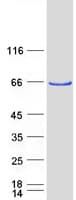 Human ATE1 Protein (Recombinant Myc-DDK (Flag))