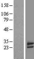 FAM18B Protein (Over-Expression Lysate Myc-DDK (Flag))