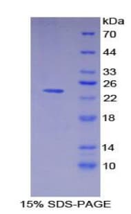 Pig HLA-DRA Protein (Recombinant His)