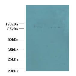 Polyclonal Rabbit anti-Human EFHB Antibody (WB)