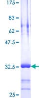 Human TMSB4X / Thymosin Beta-4 Protein (Recombinant GST)