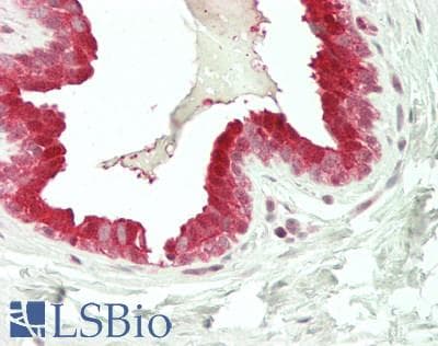 IHC-plus™ BMP5 Antibody
