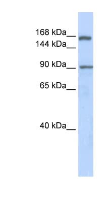 AFF2 / OX19 Antibody (aa1224-1273)