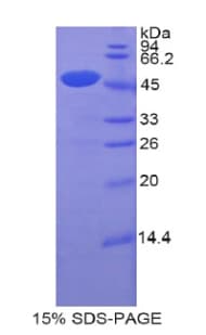 Human CDNF / ARMETL1 Protein (Recombinant His-GST)