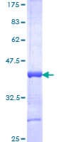 Human HOXA13 Protein (Recombinant GST, N-terminus)