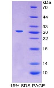 Mouse GP2 Protein (Recombinant His-T7)