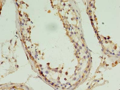 Polyclonal Rabbit anti-Human PIN1 Antibody (IHC)