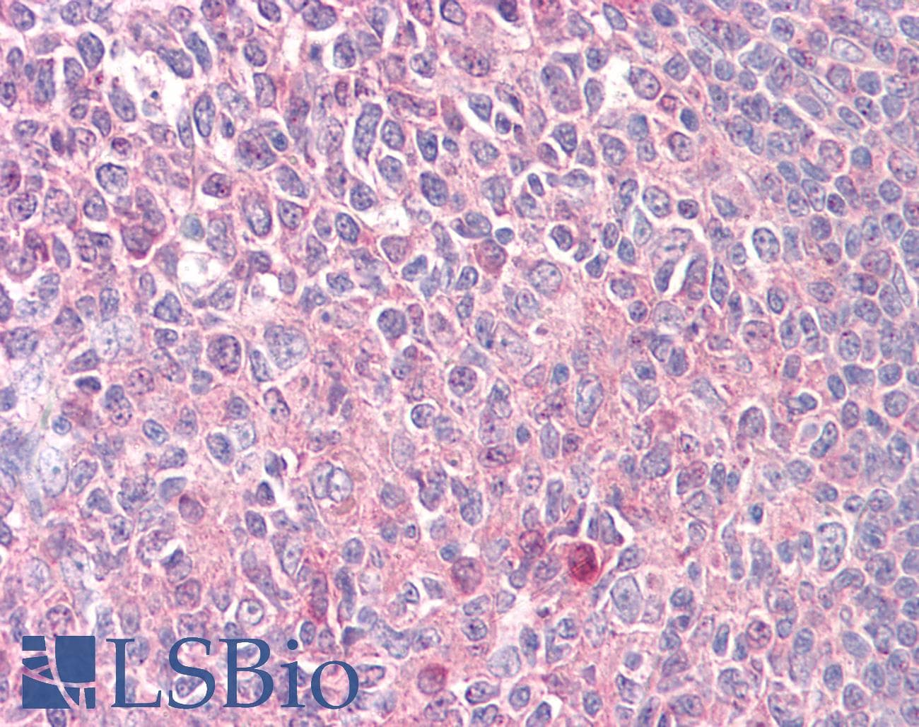 IHC-plus™ PRKCD / PKC-Delta Antibody (aa471-520)