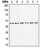 Polyclonal Rabbit anti-Human JUN / c-Jun Antibody (Internal, IHC, WB)