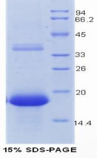 Mouse REG3G Protein (Recombinant 6His, N-terminus)