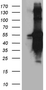 TANK Antibody (clone OTI1G2)