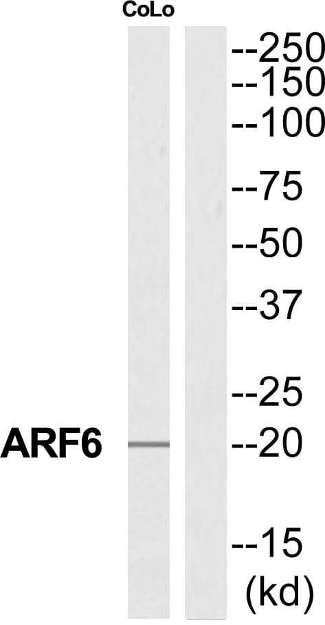 Polyclonal Rabbit anti-Human ARF6 Antibody (WB)