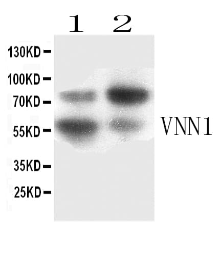 Polyclonal Rabbit anti-Human VNN1 Antibody (WB)
