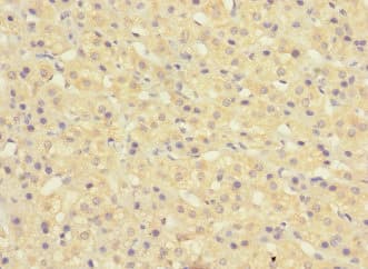 KIAA1161 Antibody