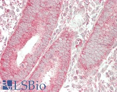 IHC-plus™ RPL35 / Ribosomal Protein L35 Antibody (aa42-91)